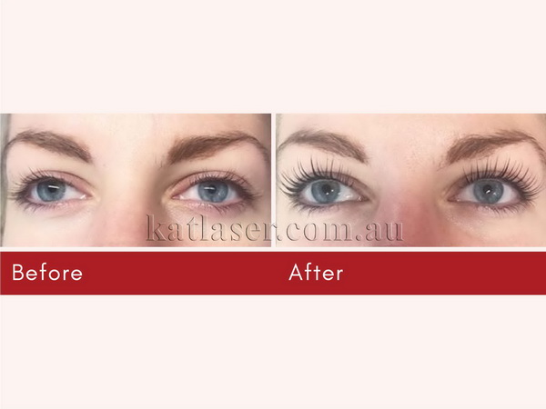 EYELASH EXTENSIONS 2