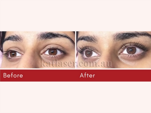 EYELASH EXTENSIONS 4