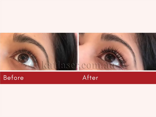 EYELASH EXTENSIONS 5